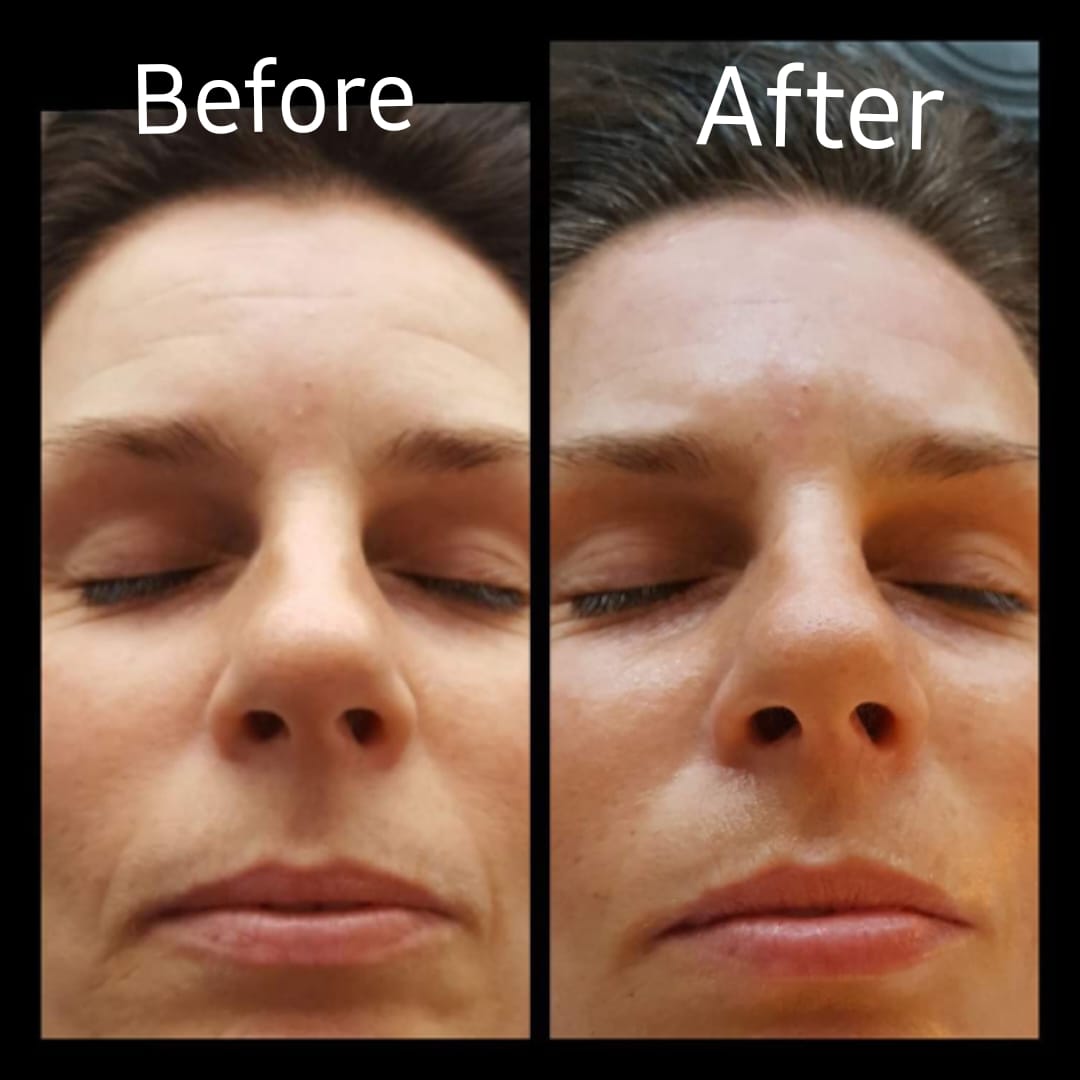 Gua Sha Facial