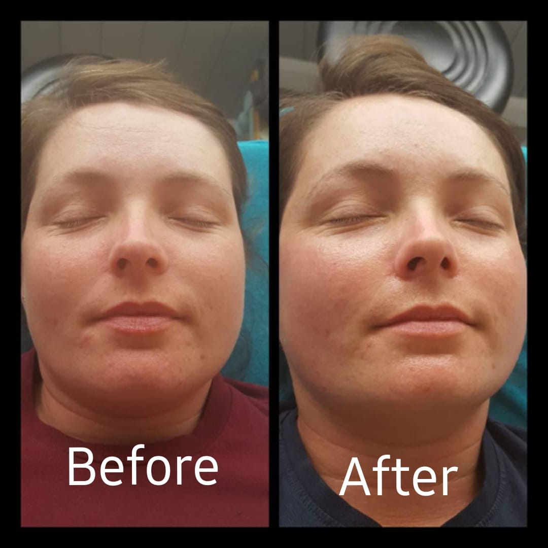 Gua Sha Facial